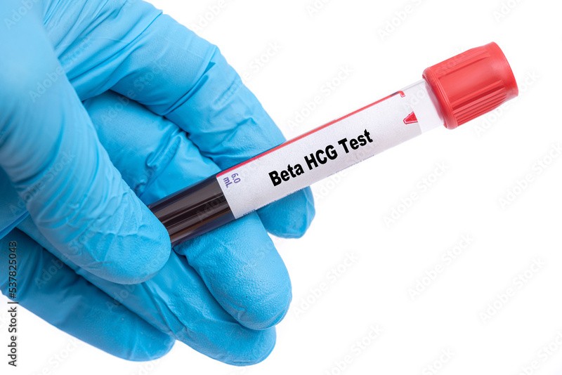Clínica para fazer exame de sangue de gravidez