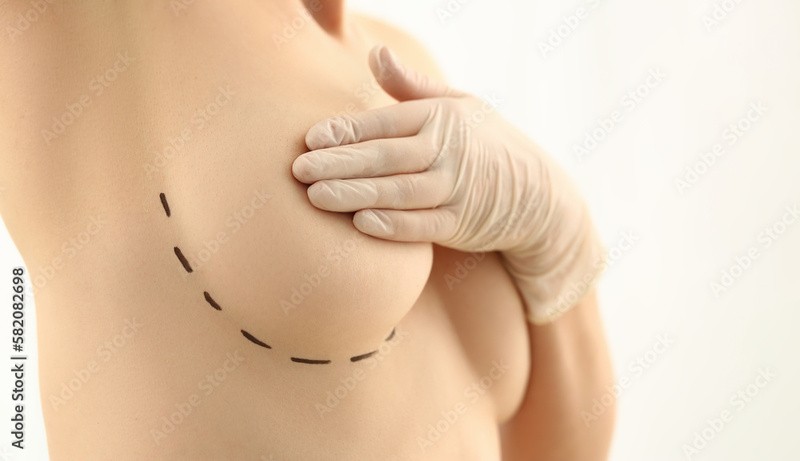 Exame de anatomopatológico mama