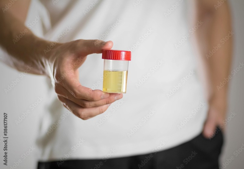 Exame de antibiograma urina