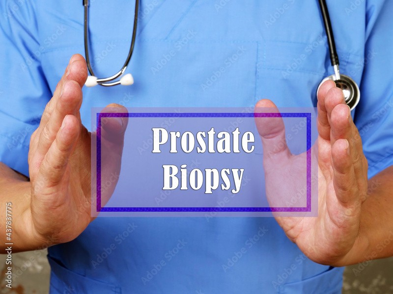 Exame de biópsia de próstata