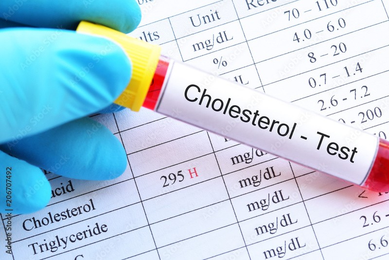 Exame de colesterol total
