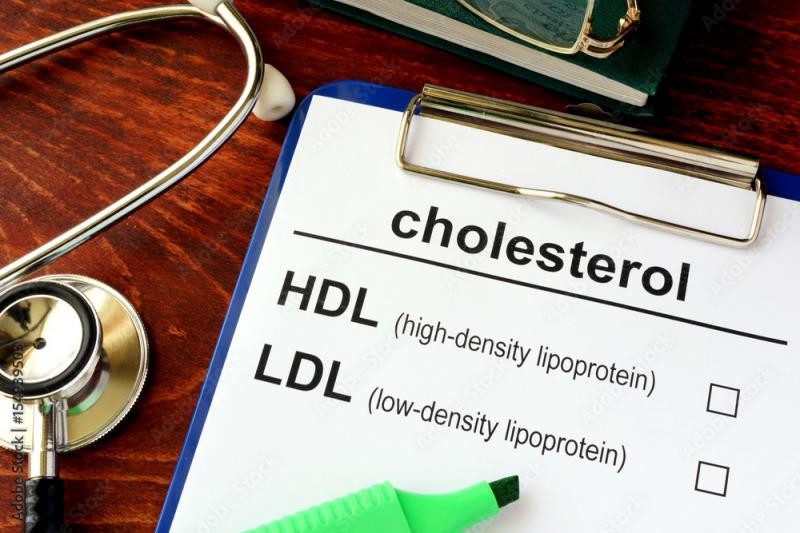 Exame de colesterol total preço