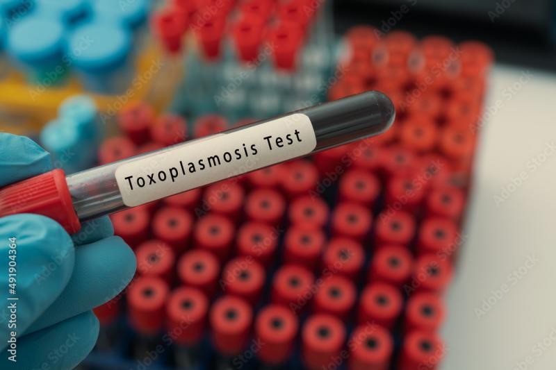 Exame de toxoplasmose igm