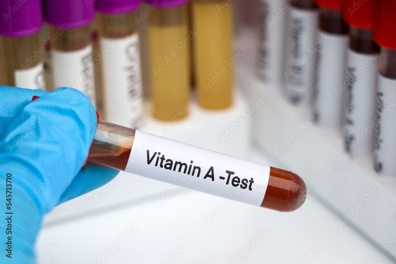 Exame de vitamina a